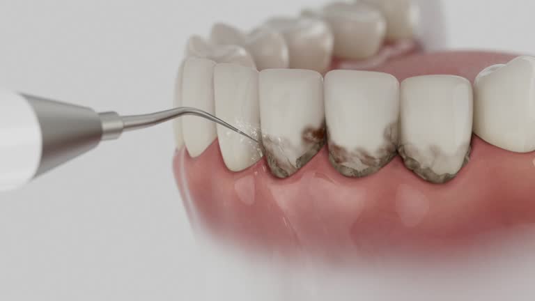 Trusted Dental Implants service in Charlotte, TX - Dentist Open Now